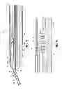Fig. 30 - Endoscopic surgical clip applier