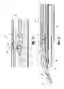 Fig. 32 - Endoscopic surgical clip applier