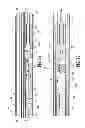 Fig. 34 - Endoscopic surgical clip applier