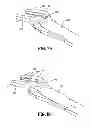 Fig. 35 - Endoscopic surgical clip applier