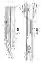 Fig. 44 - Endoscopic surgical clip applier