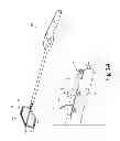 Fig. 02 - Lock bar spring and clip for implant deployment device