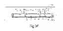 Fig. 07 - Lock bar spring and clip for implant deployment device