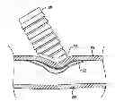 Fig. 01 - Implantable flow connector