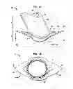 Fig. 02 - Implantable flow connector