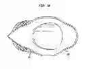 Fig. 06 - Implantable flow connector