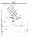 Fig. 09 - Implantable flow connector