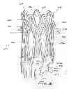 Fig. 43 - Implantable flow connector