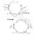 Fig. 49 - Implantable flow connector