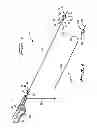 Fig. 02 - Rotational thrombectomy wire with blocking device