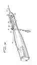 Fig. 03 - Rotational thrombectomy wire with blocking device