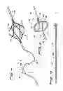 Fig. 07 - Rotational thrombectomy wire with blocking device