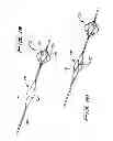 Fig. 14 - Rotational thrombectomy wire with blocking device