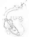 Fig. 01 - Apparatus, system, and method for treating a regurgitant heart valve