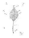 Fig. 02 - Apparatus, system, and method for treating a regurgitant heart valve