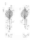 Fig. 06 - Apparatus, system, and method for treating a regurgitant heart valve