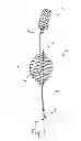 Fig. 07 - Apparatus, system, and method for treating a regurgitant heart valve