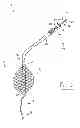 Fig. 08 - Apparatus, system, and method for treating a regurgitant heart valve