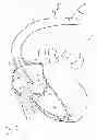 Fig. 09 - Apparatus, system, and method for treating a regurgitant heart valve