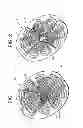 Fig. 02 - Occluding Device
