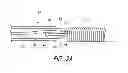 Fig. 06 - Aneurysm treatment coils