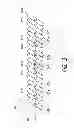 Fig. 08 - Aneurysm treatment coils