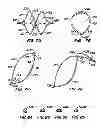 Fig. 07 - Methods for providing protection during procedures in the vasculature