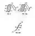 Fig. 09 - Methods for providing protection during procedures in the vasculature