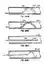 Fig. 35 - Methods for providing protection during procedures in the vasculature