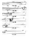 Fig. 45 - Methods for providing protection during procedures in the vasculature