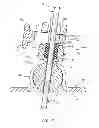 Fig. 06 - Procedural sheath securement device and methods