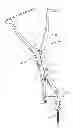 Fig. 01 - SOINAL IMPLANT SYSTEM AND METHOD
