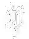 Fig. 02 - Spinal correction system and method