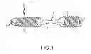 Fig. 02 - Bent dip fusion screw