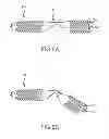 Fig. 06 - Bent dip fusion screw