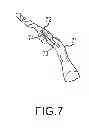 Fig. 08 - Bent dip fusion screw