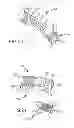 Fig. 22 - Bent dip fusion screw
