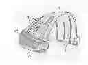 Fig. 01 - Three dimensional life-size model of a child's skull and method using said model