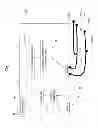 Fig. 02 - Use of Electric Fields for Reducing Patient Discomfort During Defibrillation