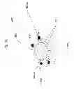 Fig. 09 - Use of Electric Fields for Reducing Patient Discomfort During Defibrillation