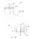 Fig. 02 - Apparatus and method for treating obstructive sleep apnea