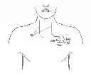 Fig. 01 - Systems and methods for avoiding neural stimulation habituation