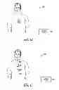 Fig. 07 - Systems and methods for avoiding neural stimulation habituation