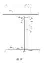 Fig. 02 - Electrode for finding points of low impedance and applying electrical stimulation thereto
