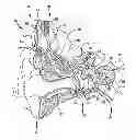 Fig. 01 - Implantable tissue stimulating electrode assembly