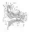 Fig. 02 - Implantable tissue stimulating electrode assembly