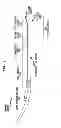 Fig. 03 - Implantable tissue stimulating electrode assembly