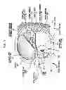 Fig. 07 - Implantable tissue stimulating electrode assembly