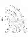 Fig. 11 - Implantable tissue stimulating electrode assembly