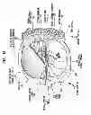 Fig. 12 - Implantable tissue stimulating electrode assembly